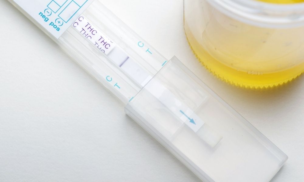 Mistakes Employers Make When Drug Testing Employees